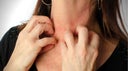 alergia-a-la-visuteria-2