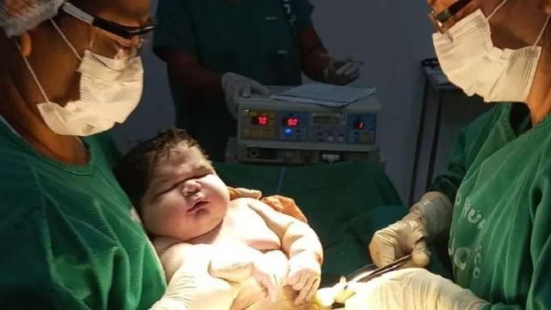 Bebé de 7 kilos en Brasil