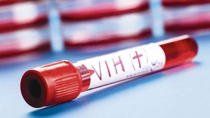 Casos de VIH en el Valle de Sula
