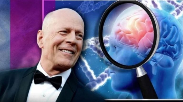 Bruce Willis demencia frontotemporal