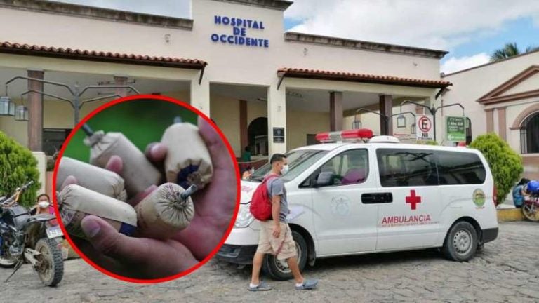 Niños con quemaduras por explosión de bomba