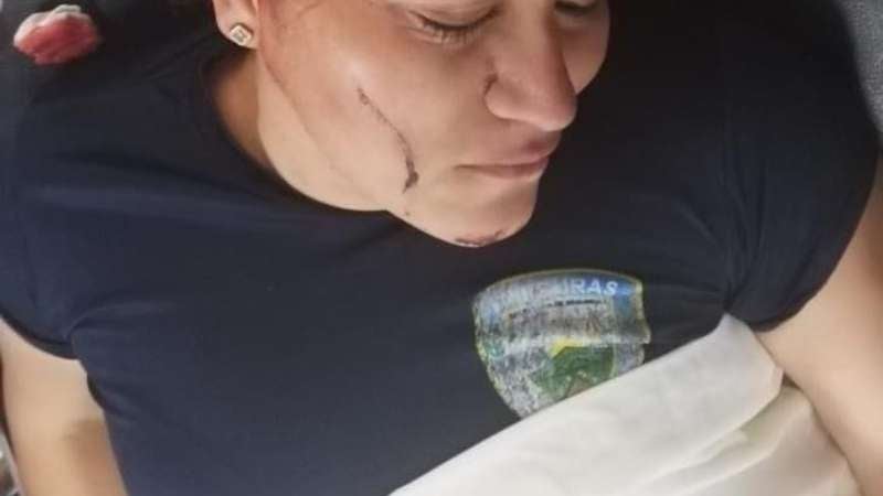 Varios disparos le rosaron a una de las oficiales de policía.