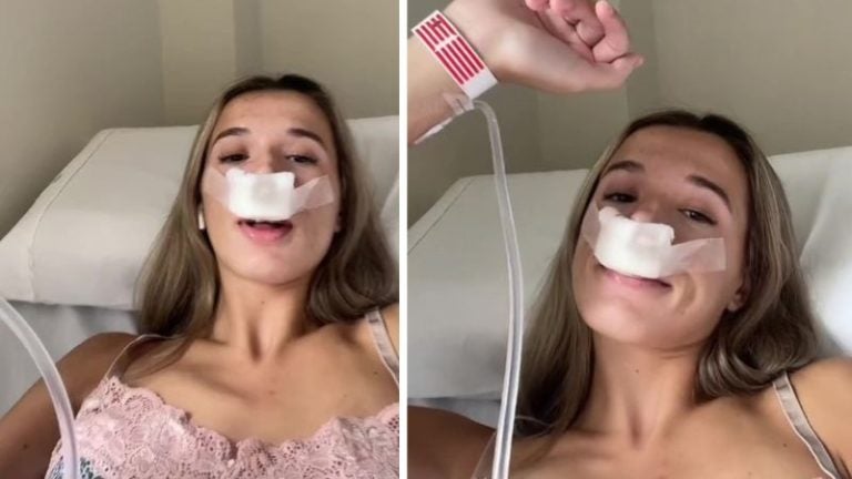 Tiktoker se opera la nariz para que sus hijos «nazcan lindos»