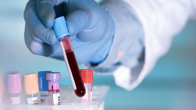 Nuevo análisis de sangre podría ayudar a detectar más de 50 tipos de cáncer