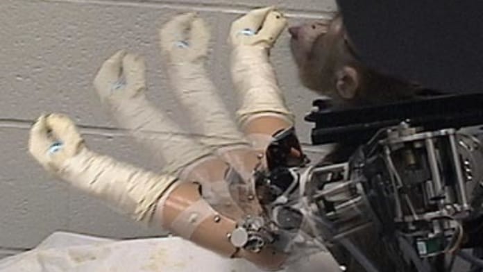 La imagen muestra el procedimiento quirúrgico realizado en el mono mientras recibe el implante cerebral.