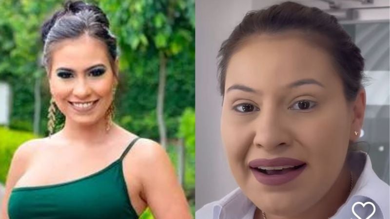 Lluvia de críticas a Alejandra Rubio por “abusar” del botox