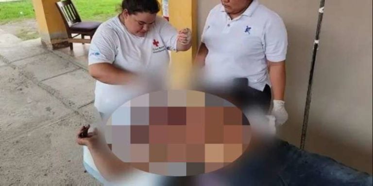 Copaneca propicia golpiza a su marido tras acalorada discusión