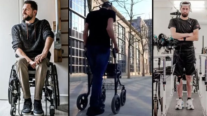 Paralítico vuelve caminar implante cerebral