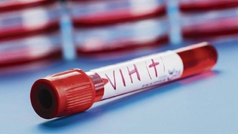 Nuevo método prevención VIH Sudáfrica