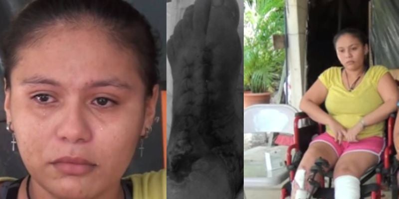 Hondureña pierde una pierna al intentar subir el tren "La Bestia", en México