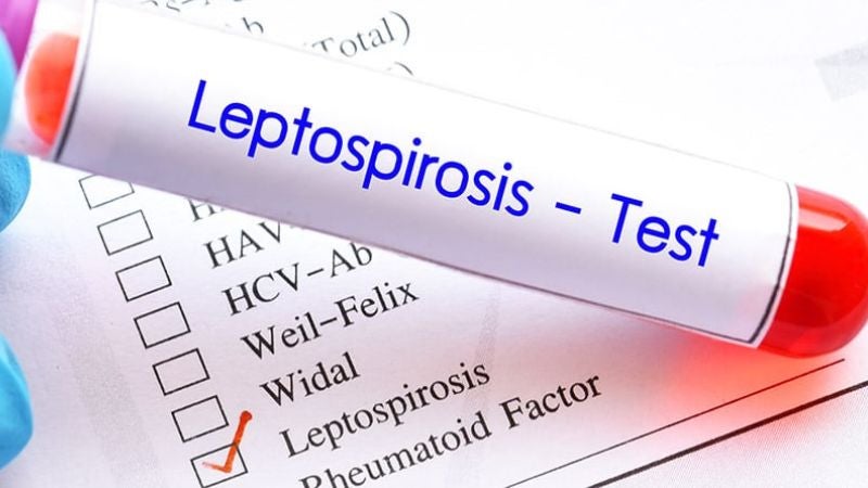 Confirman leptospirosis La Ceiba