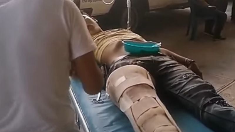 Al menos 6 corteros de café heridos deja accidente en San Jerónimo, Copan