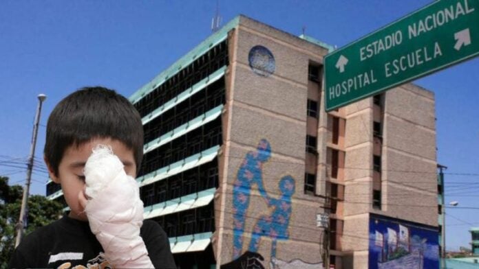 niño quemado ingresa al Hospital Escuela