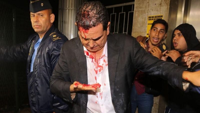 Antonio Rivera se operará en EEUU por supuestas secuelas de la "golpiza" propiciada por colectivos