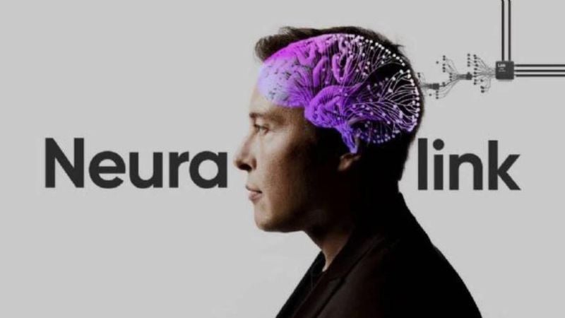 Sin efectos secundarios reacciona primer paciente con chip cerebral de Elon Musk