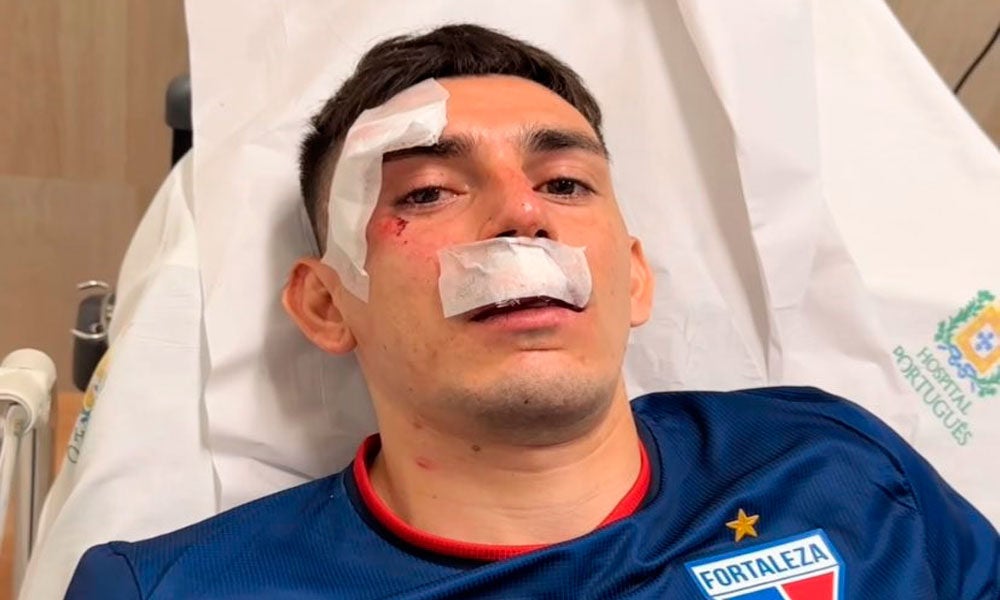Futbolistas heridos