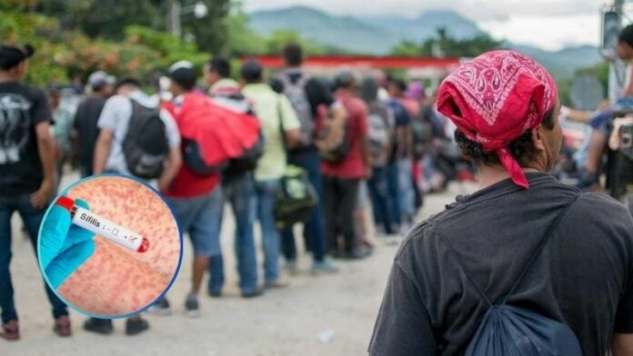 ONG alerta de que tres de cada 10 migrantes en la frontera sur de México tienen sífilis