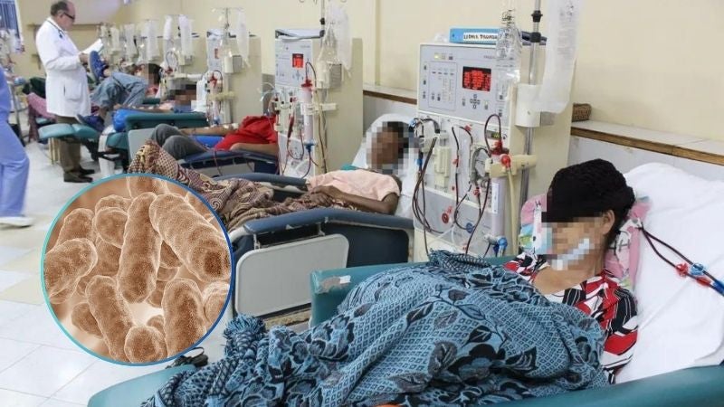 Sesal registra al menos 40 Pacientes renales contagiados de Serratia, por supuesta negligencia