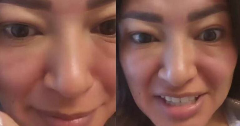 Milagro Flores sorprende a sus seguidores por su rostro inflamado ¿Qué le pasó?