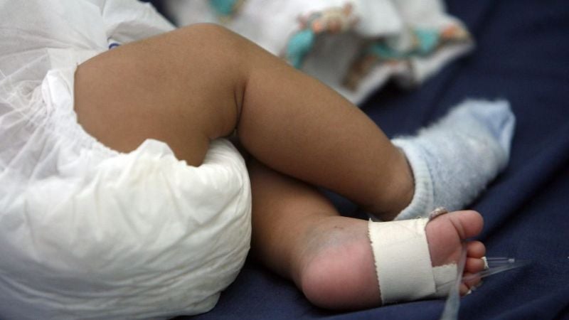 Menor sufre quemaduras en un 70% de su cuerpo en La Unión, Copán