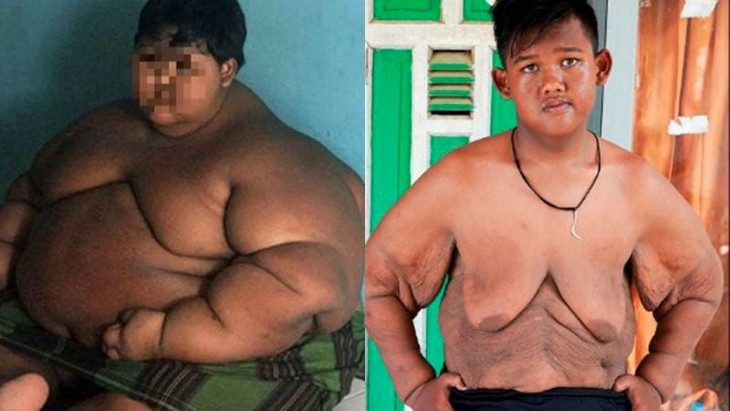 cambio niño más gordo del mundo