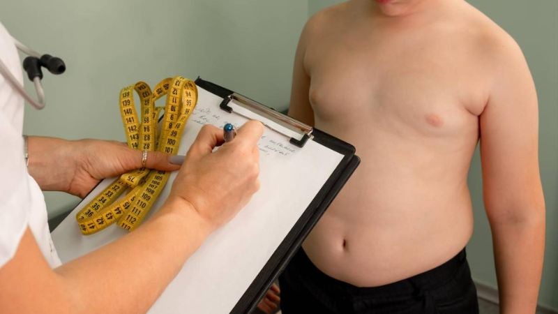 La obesidad es una enfermedad crónica común que se caracteriza por una acumulación anormal de grasa en el cuerpo, que no es saludable.