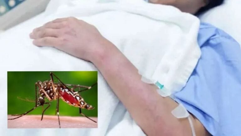 Dengue