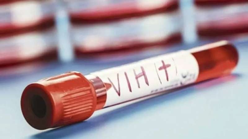 Casos de VIH en El Progreso