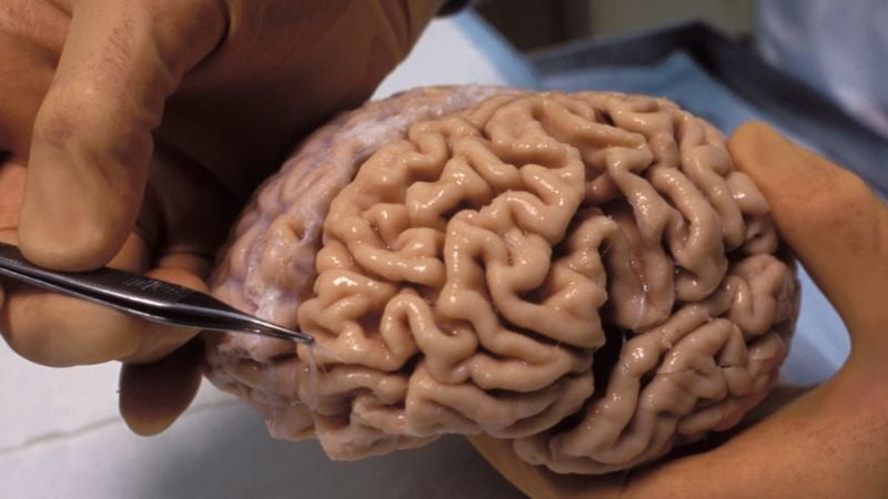 Científicos chinos reviven tejido cerebral humano