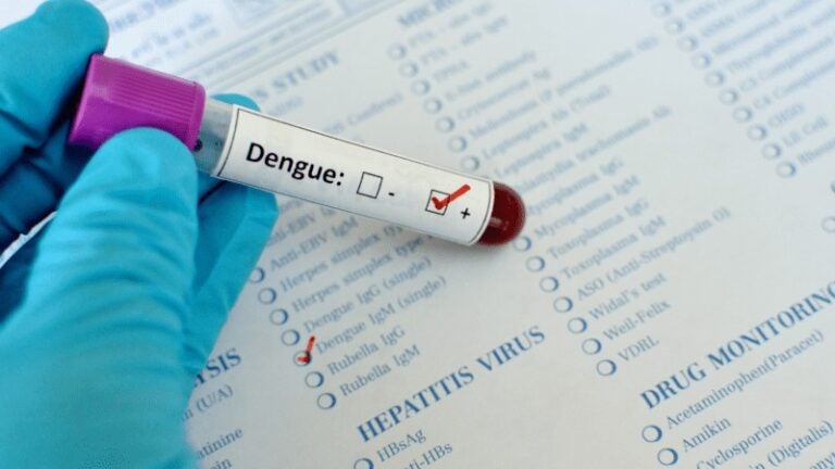 Salud no descarta declarar emergencia por aumento de casos de dengue en el DC
