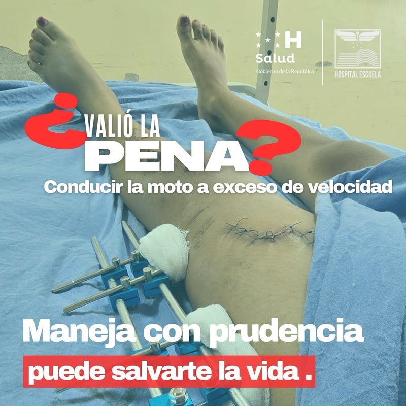 Accidente motocicletas 