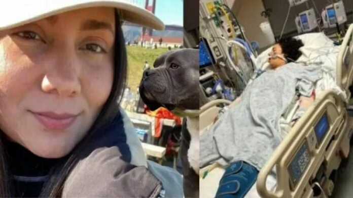 Ataque de pitbulls deja a joven en cuidados intensivos