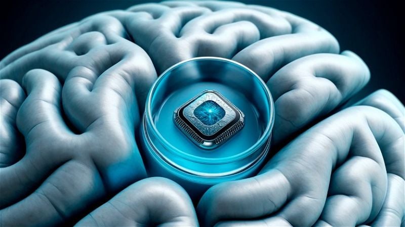 Musk: Neuralink ya está lista para hacer un segundo implante de chip cerebral