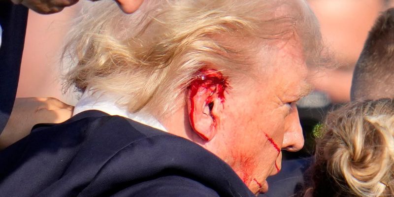 Bala que rozó a Trump dejó herida de 2 cm según su médico