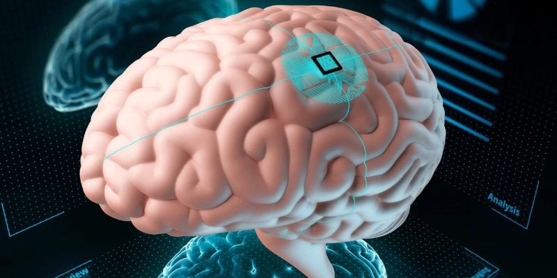 Este implante cerebral permite a las personas controlar una Alexa con la mente