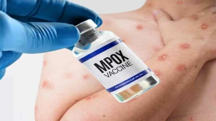 USA donará un millón de vacunas contra la mpox a países africanos