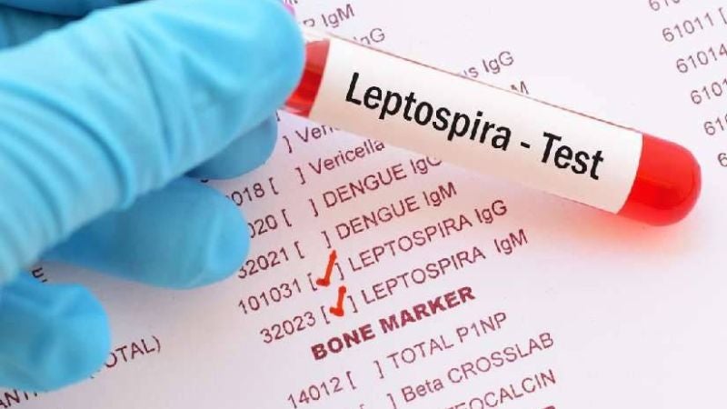 La leptospirosis