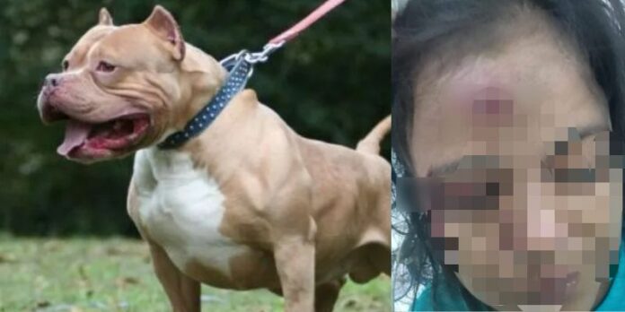 Pitbull ataca a una joven que iba hacia una iglesia en SPS