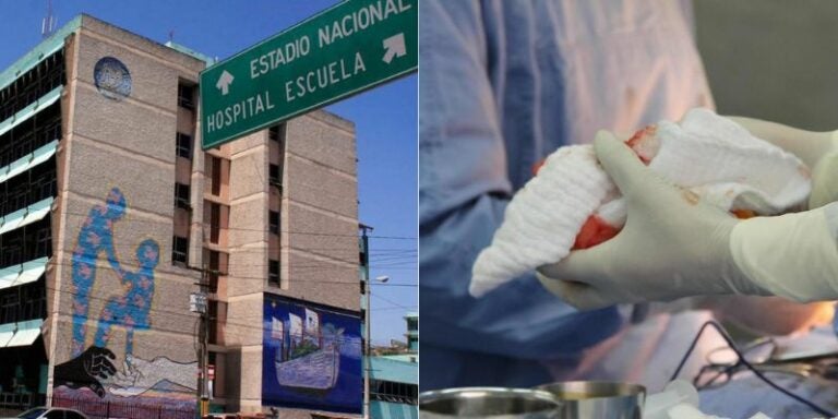 Mediante compra de emergencia ingresan rollos de algodón al Hospital Escuela