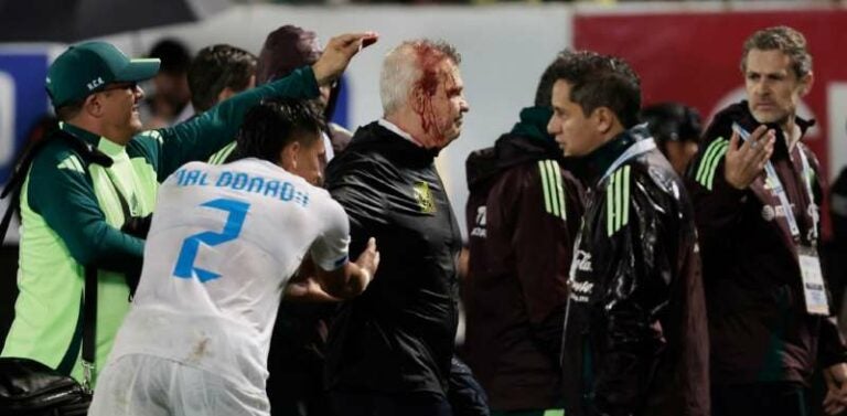 Hondureño podría ser acusado de un delito por atacar a Javier Aguirre