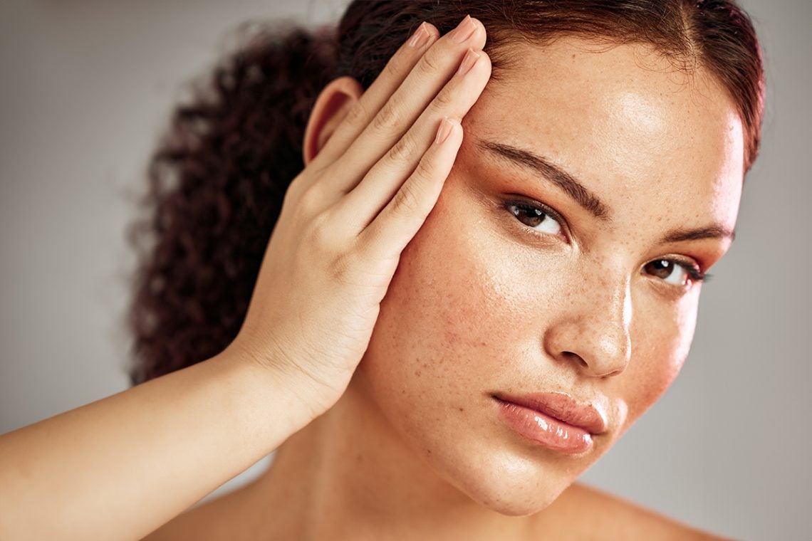 Este tratamiento reduce la acumulación de melanina, responsable de las manchas, y mejora la textura y el tono de la piel.