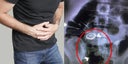 dolor-abdominal