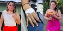 mujer-recibe-nueve-disparon-en-danli