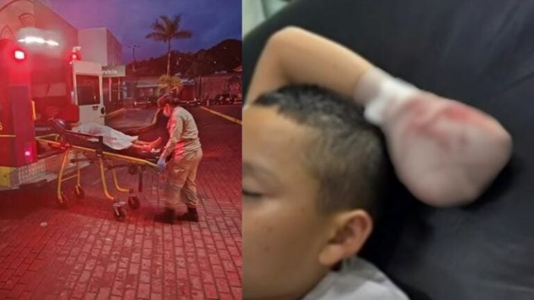 Niño de 10 años pierde su mano en Islas de la Bahía