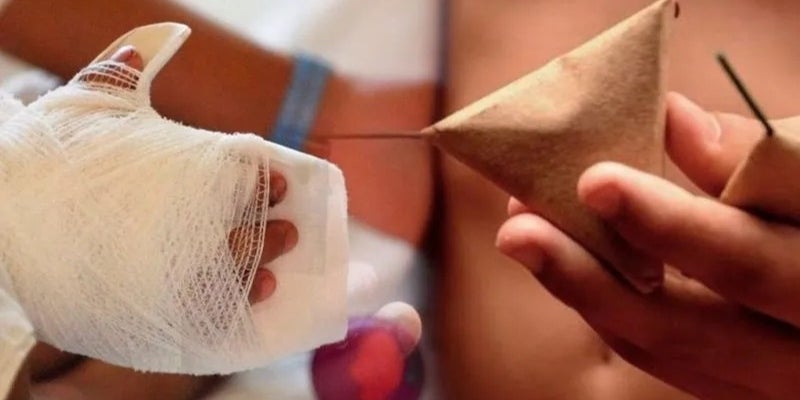 15 niños quemaduras pólvora