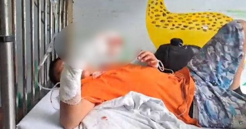 "Yo lo quise tirar": Niño relata cómo un cohete le explotó en su mano