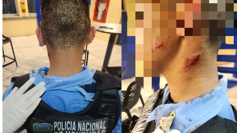 Detenido por agredir a policías