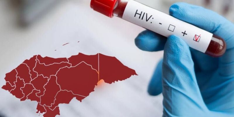 Conadeh: 90 casos mensuales de VIH se detectaron en el 2024