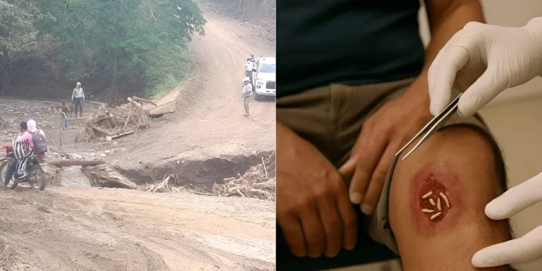 Confirman en Yoro primer caso humano de gusano barrenador