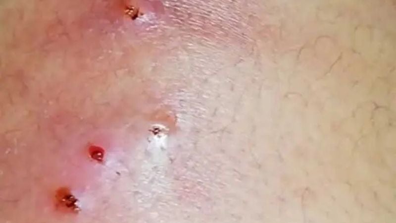 Médico cuestiona protocolos de la Sesal 